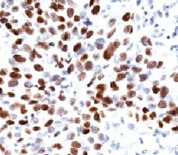 p21 Antibody