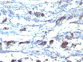 CCR5 Antibody