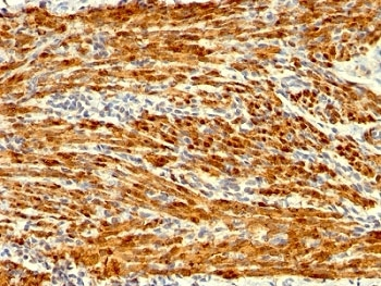 Calponin Antibody