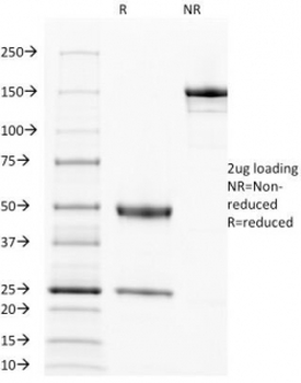 EGFR Antibody / Epidermal Growth Factor Receptor