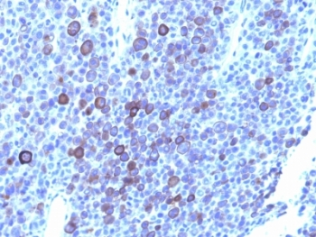 Glypican-3 Antibody Cocktail