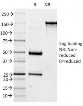ABO Antibody / Blood Group Antigen A