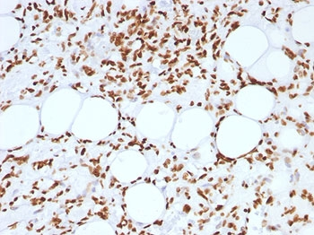 Histone Antibody / Histone H1