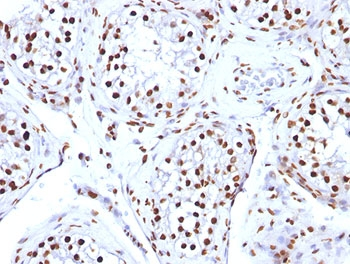 Histone Antibody / Histone H1