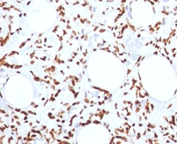 Histone Antibody / Histone H1