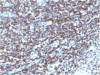 Histone Antibody / Histone H1