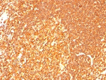 HLA-DR Antibody Cocktail (MHC II)