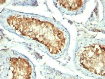 HSP60 Antibody / HSPD1