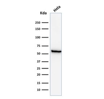 HSP60 Antibody / HSPD1