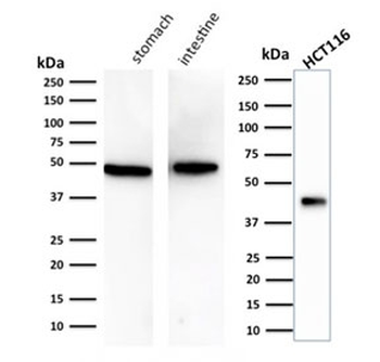 Cytokeratin 18 Antibody