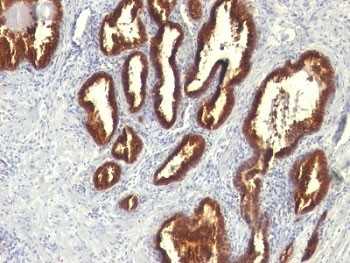 Cytokeratin 18 Antibody