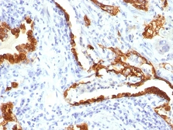 Cytokeratin 18 Antibody