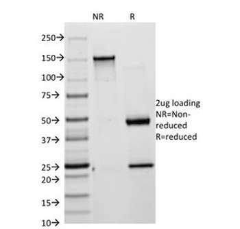 Cytokeratin 18 Antibody