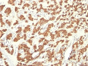 Cytokeratin 18 Antibody