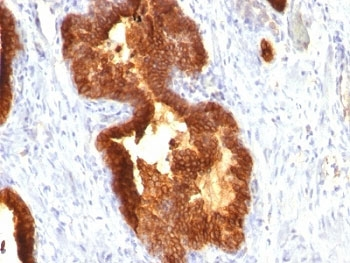 Cytokeratin 18 Antibody