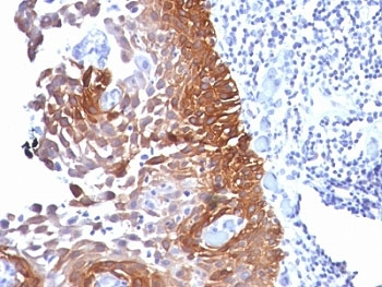 Cytokeratin 18 Antibody Cocktail