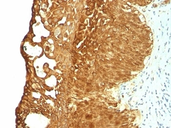 Cytokeratin 19 Antibody