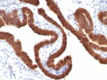 Cytokeratin 19 Antibody