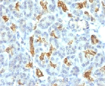 Cytokeratin 19 Antibody