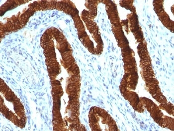 CK19 Antibody / Cytokeratin 19