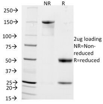 CD56 Antibody / NCAM / Extracellular domain