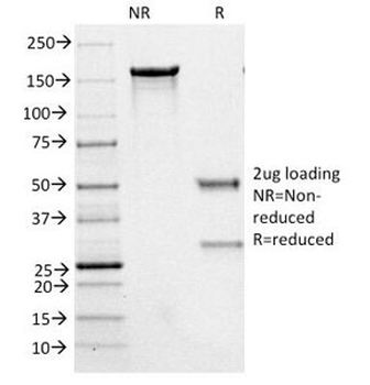 NF-H Antibody (phospho)
