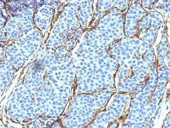NGF Receptor Antibody