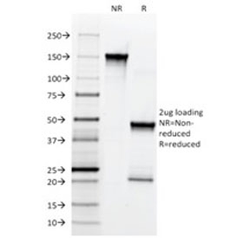 NGF Receptor Antibody