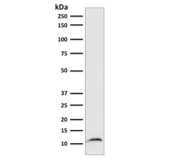 Beta-2 Microglobulin Antibody