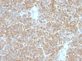 Bcl-2 Antibody Cocktail