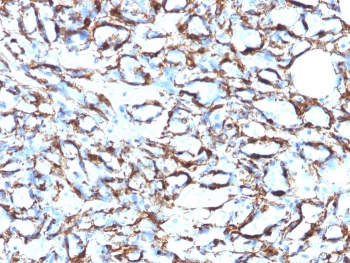 ACTA2 Antibody Cocktail / Alpha Actin