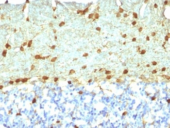 Fascin Antibody