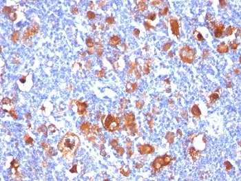 Fascin Antibody