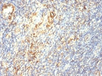 Transglutaminase 2 Antibody