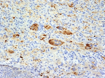 TNF-alpha Antibody