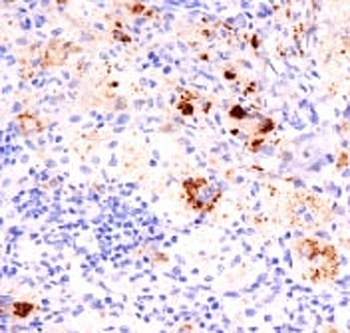 TNF-alpha Antibody Cocktail