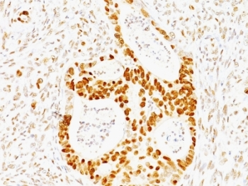 p53 Antibody