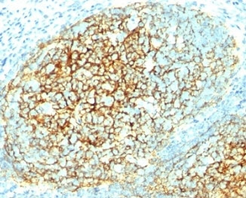 VCAM-1 Antibody