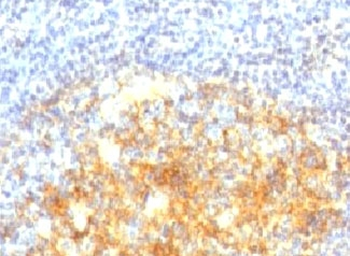 VCAM1 Antibody