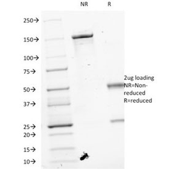 VEGF Antibody / VEGFA
