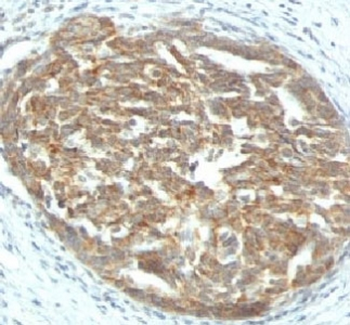 VEGF Antibody / VEGFA