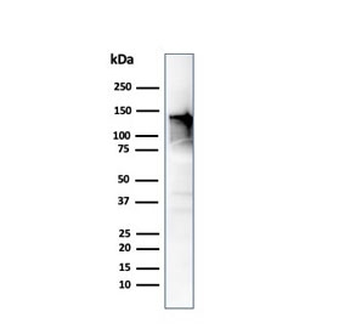 CAD Antibody / CALD1 / Caldesmon (HMW)