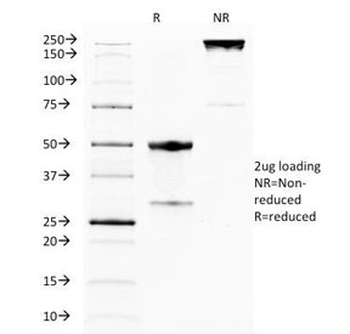 GITR Antibody (TNFRSF18)
