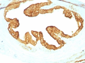 Pan Cytokeratin Antibody