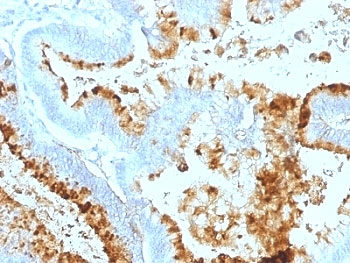 Blood Group Lewis a Antibody