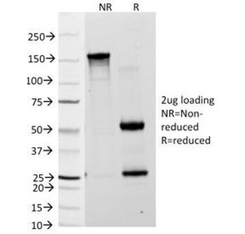 Blood Group Lewis a Antibody