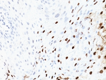 HPV-16 Antibody