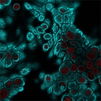 Pan Cytokeratin Antibody Cocktail