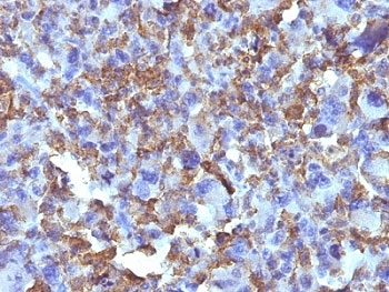 Macrophage / Histiocytoma Marker Antibody