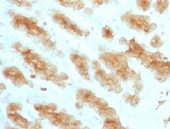 Acidic Cytokeratin Antibody